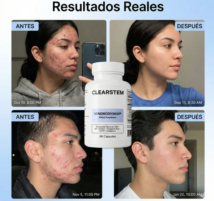 CLEARSTEM - CAPSULA PARA EL ACNE